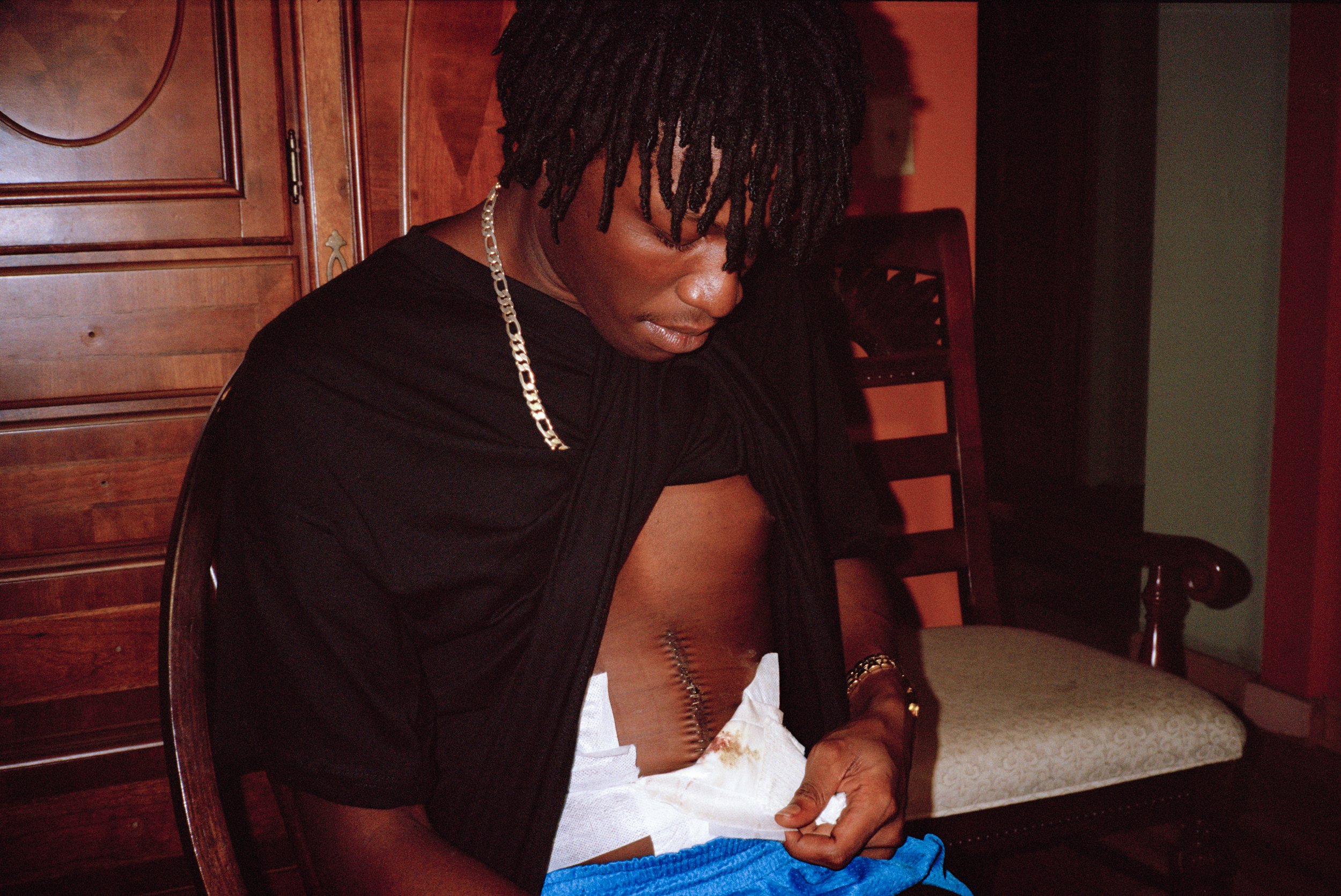 A seated person lifting their shirt to reveal a bandage.